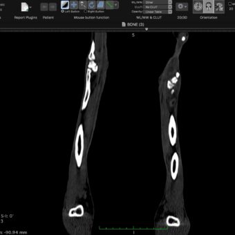 CT scan DICOM data processing for veterinary bone model creation