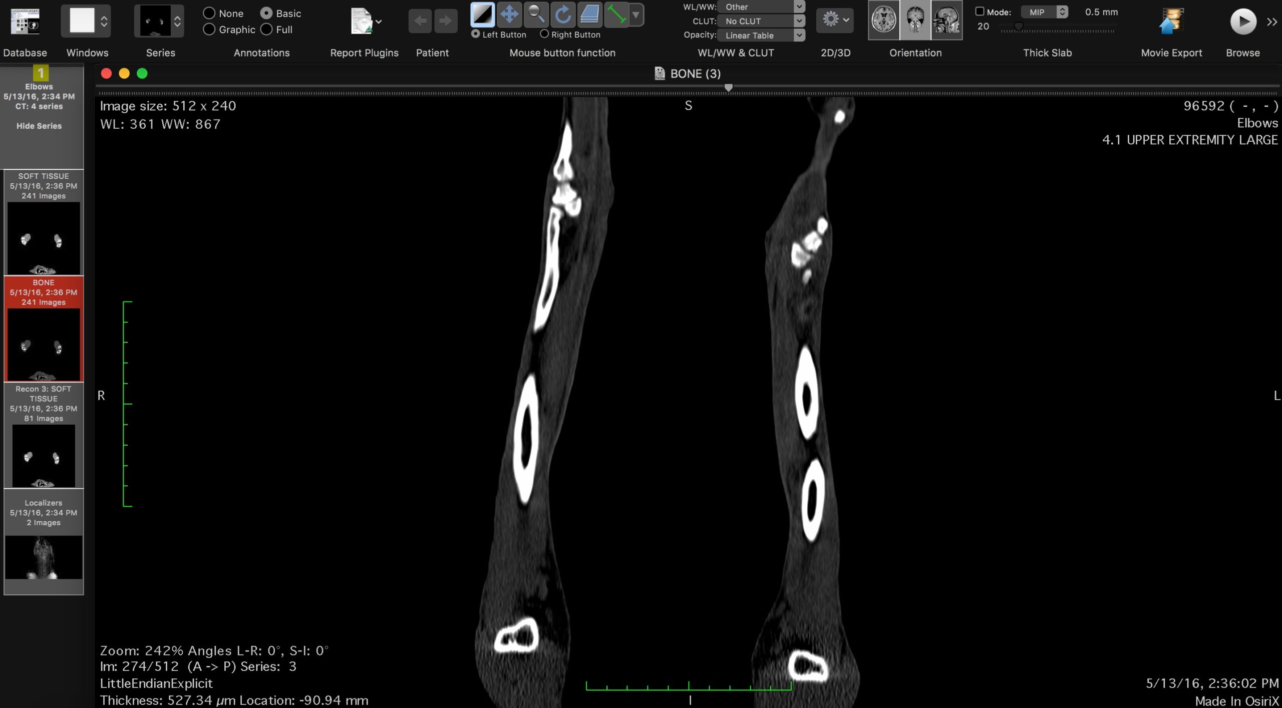 CT scan DICOM data processing for veterinary bone model