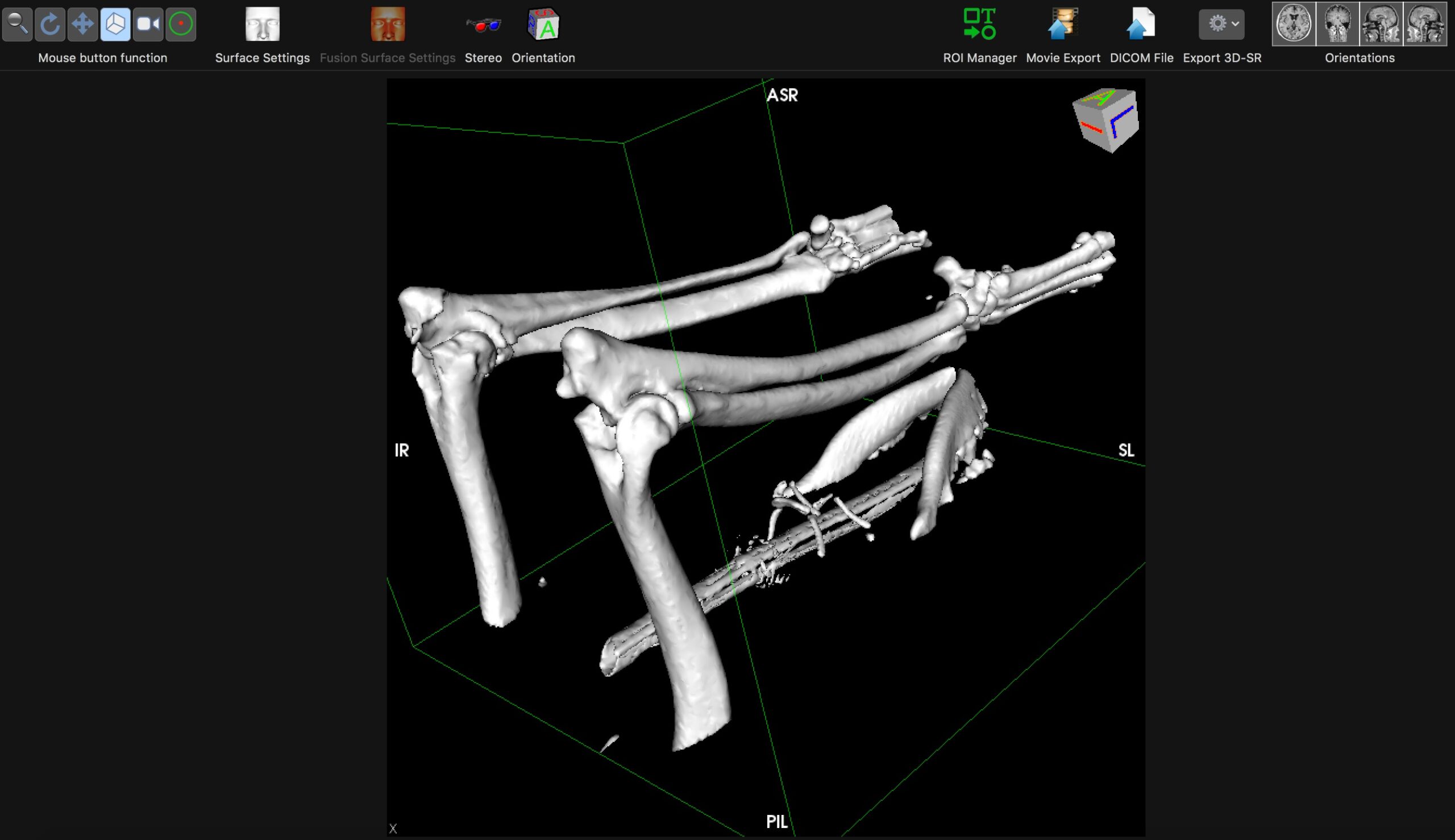 3D rendering from CT scan data for veterinary surgical planning
